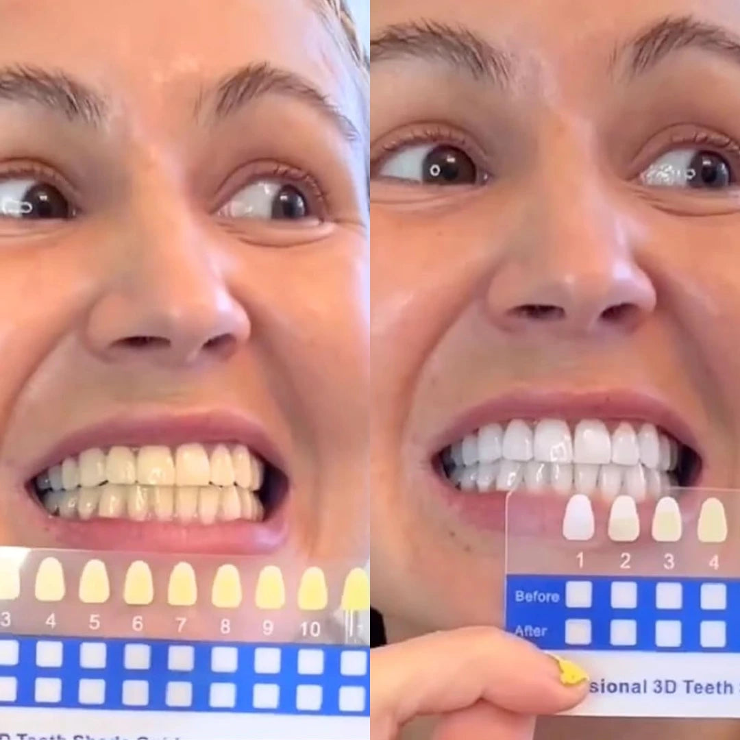 Kit sbiancante con tecnologia SmileNow®